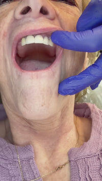 Revive Veneers