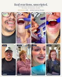 Revive Veneers